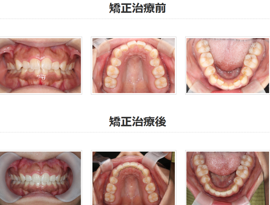 症例・治療例 | 千葉県柏市で歯列矯正なら柏KT矯正歯科