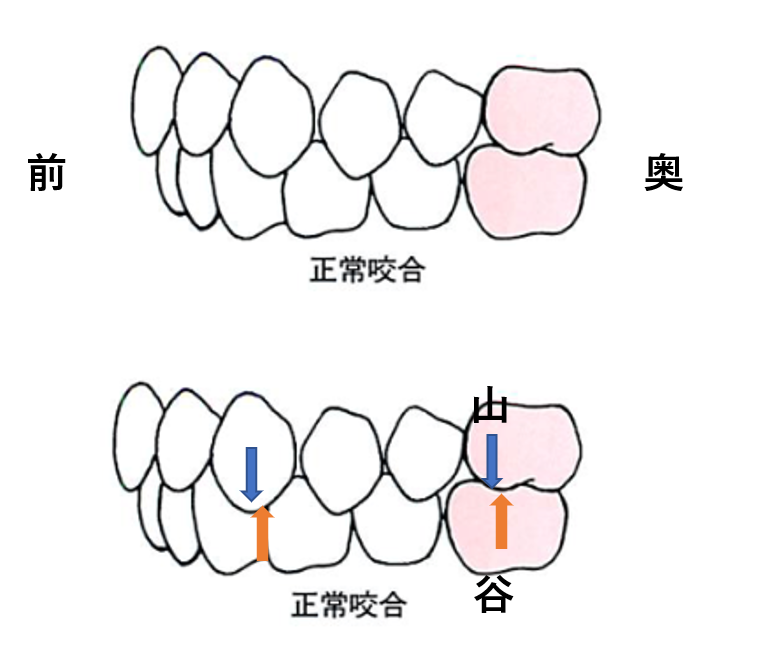 部分矯正のメリットやデメリット。全顎矯正とは何が違うの？